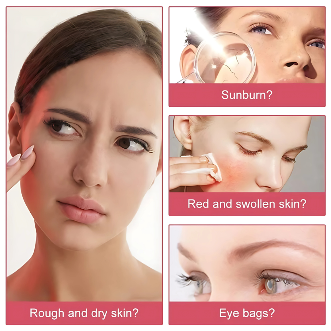 Face Ice Roller for Acne, Pore Tightening & Skin Lifting